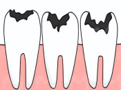 牙齒爛得只剩牙根，上深圳揾牙醫仲有冇得補救？