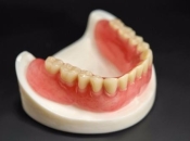 全口吸附性義齒是什麼？深圳全口吸附性義齒多少錢？