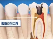 北上杜牙根收費，顯微杜牙根同常規杜牙根有咩區别？ 