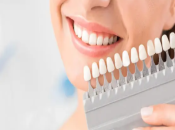 深圳牙齒美白——牙齒美學修復方式有哪些呢？