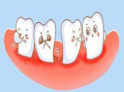 深圳牙周治療——成人牙周炎是怎樣的呢？