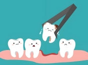 落馬洲口岸牙科維港口腔科普：剝牙一次只可以剝一隻嗎？深圳剝牙收費？