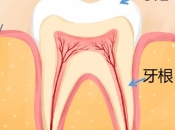 牙齿得咗牙髓炎之後疼痛劇烈同咩有關？如果治療價格係幾多？