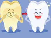 什麽是四環素牙？該如何治療？