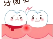 【深圳牙周治療實戰手冊】跨境就診的科學流程與技術突破