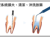 深圳牙科杜牙根收費？杜牙根一定要按時複診？