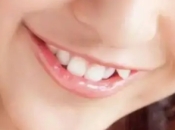 深圳箍牙——為什麼很多兒童牙齒畸形不會及時治療呢？