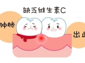 青春期齦炎主要病因