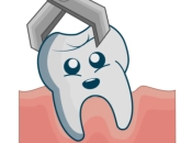 深圳剝牙之後醫生竟然建議我食雪條？深圳羅湖拔牙100蚊搞掂？