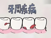 牙周炎是否會通過唾液傳染？深圳牙周治療收費詳情！