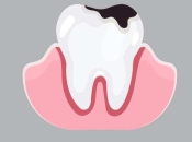 夜晚牙痛緊急處理方法？深圳牙痛治療牙科首選邊間？