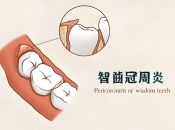 智齒發炎點算？可唔可以預防咧？維港口腔剝智慧齒收費標準