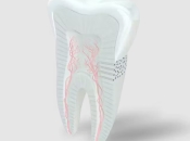 食完甜食就牙痛，係唔係就蛀牙咧？維港口腔睇蛀牙要幾錢？
