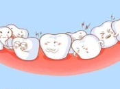 錯頜畸形的矯治方法