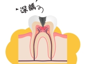 牙齒似“觸電”一樣痛，最好上深圳維港口腔睇下情況！