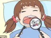 深圳牙醫解答：小朋友仲未換牙，牙痛嘅話直接剝牙好唔好？