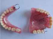 深圳維港口腔植牙科普—活動假牙點解會導致牙槽骨萎縮咧？
