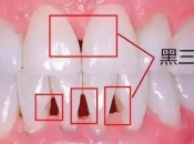 黑三角如何造成？深圳是否能夠解決黑三角問題？