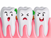 牙齒點解會出現敏感痛咧？深圳補牙幾錢一隻？