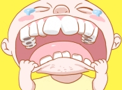如何預防小孩子齙牙