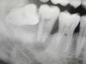 深圳種植牙專家高利民醫師，宣導回歸醫療本質、以人為本