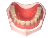 深圳鑲牙——全口義齒修復為什麼要比例和諧呢？