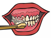 在深圳—为什么牙龈经常出血？