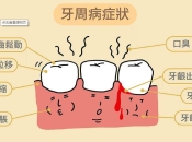 在深圳牙周病是什麼病