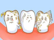 氟斑牙怎麼才能變白？