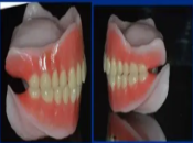 深圳鑲牙——全口義齒修復為什麼要講究多樣統一呢？