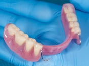 活動假牙揀鋼托定純鈦托好？羅湖整活動假牙邊間好？