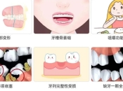 大陸種植牙推薦，長期缺牙對身體有咩危害？