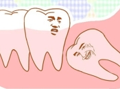 剝智慧齒之後出現冠周炎點算？深圳剝智慧齒邊度好？價錢係幾多？
