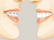 大陸牙科箍牙，錯頜畸形卻唔箍牙嘅危害性有邊些？