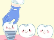 深圳維港口腔植牙——植牙術後要點樣維護咧？