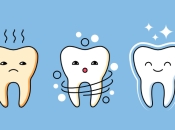 福田牙齒美白係點樣嘅咧？福田牙齒美白discount？