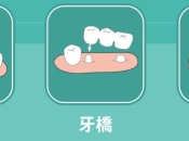 深圳整假牙邊間牙科比較好？三種假牙點揀？