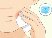 羅湖拔牙冰敷消腫小tips！羅湖脫牙幾錢？