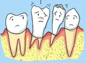 牙周病系咩，如果治療牙周炎需要幾多錢？附五大危害影響！