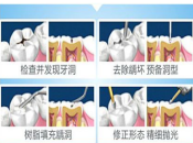 深圳牙科門牙修復，門牙缺損可以用樹脂補牙咩？