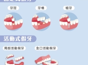 假牙應該點樣清潔維護咧？深圳牙科邊間好？