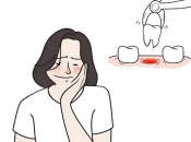大陸剝牙之後痛咗幾日正常嗎？深圳牙科邊間好？