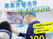 大陸洗牙有邊幾種？深圳洗牙價錢2025？