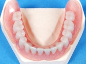 活動假牙應該點樣清洗咧？深圳長者假牙價錢？