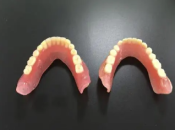 深圳鑲牙——全口義齒修復為什麼要協調對比呢？