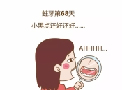 蛀牙了以後補牙都需要鑽洞嗎？