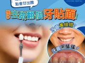 牙貼片有冇後遺症？深圳睇牙整牙貼面要幾錢？深圳維港口腔地址！