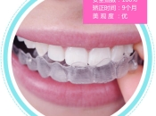 深圳隱適美箍牙邊間好？隱適美大概幾錢？