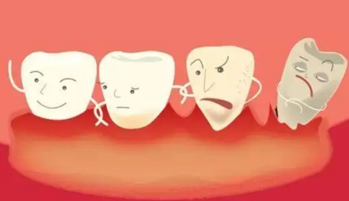 深圳牙周治療—牙周炎與老年癡呆症有關系嗎？