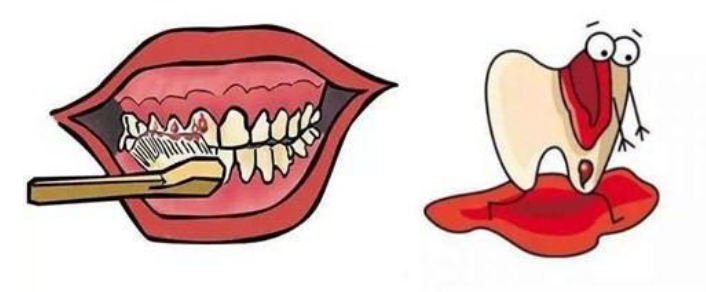 深圳牙周治療-白血病和牙齦出血有關嗎？